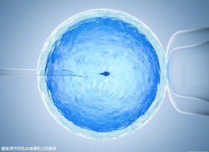 李雪梅